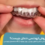بهترین روش ارتودنسی دندان
