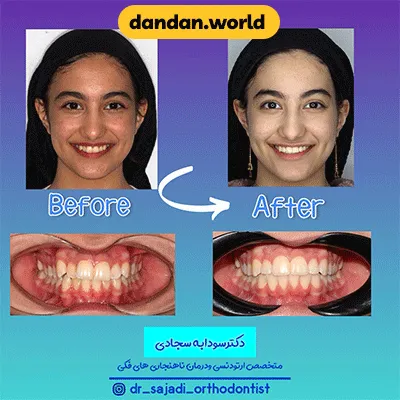 نمونه کار ارتودنسی دکتر سودابه سجادی