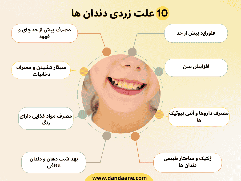 اینفوگرافی علت زردی دندان
