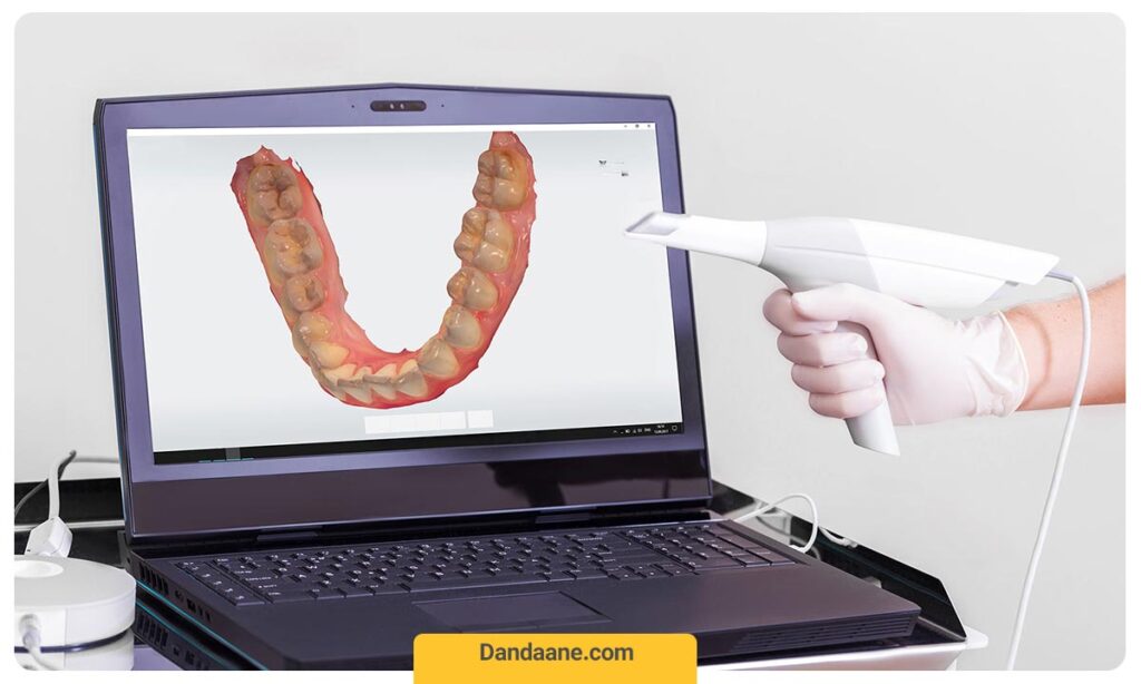 اسکنر پزشکی از تجهیزات ضروری لمینت دندان