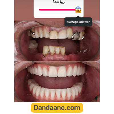 نمونه کار قبل و بعد دکتر شیرین لواف - شماره 1