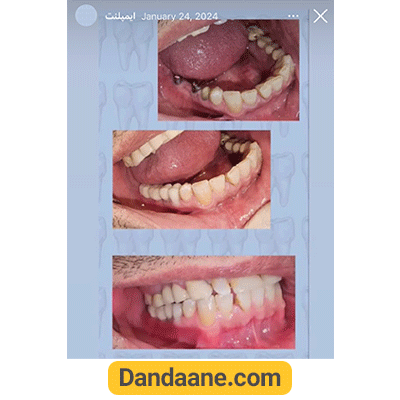 نمونه کار قبل و بعد دکتر شیرین لواف - شماره 2