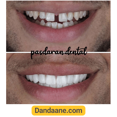 نمونه کار قبل و بعد دکتر شیرین لواف