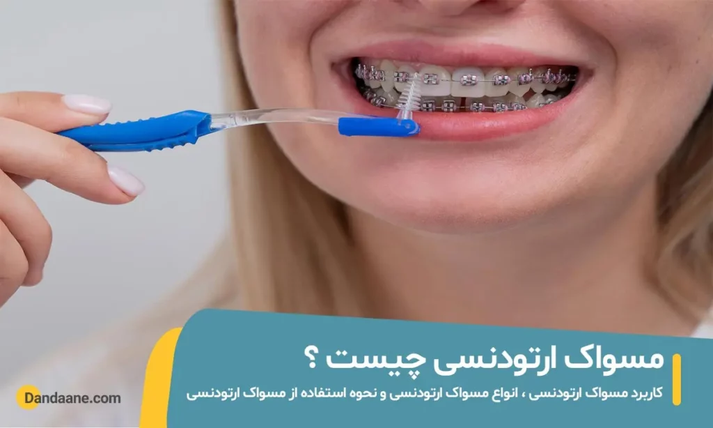 مسواک ارتودنسی چیست؟