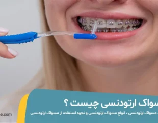 مسواک ارتودنسی چیست؟