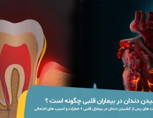کشیدن دندان در بیماران قلبی