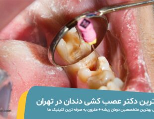 دکتر عصب کشی دندان