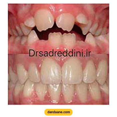 نمونه کار ارتودنسی دکتر فرهاد صدرالدینی