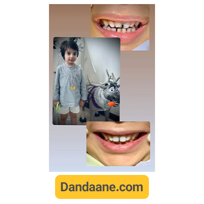 نمونه کار دکتر کوثر سادات ابطحی متخصص دندانپزشکی کودکان - شماره 1