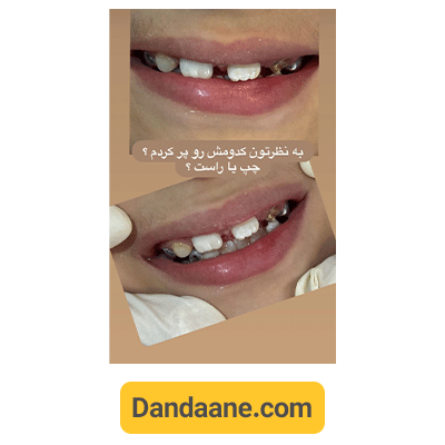 نمونه کار دکتر کوثر سادات ابطحی متخصص دندانپزشکی کودکان - شماره 2