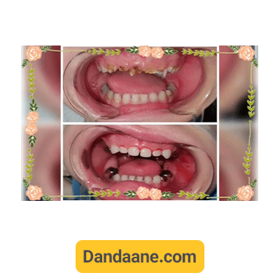 نمونه کار قبل و بعد دکتر سعیده مختاری - شماره 2