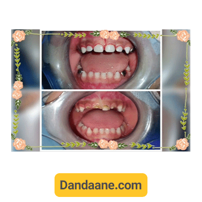 نمونه کار قبل و بعد دکتر سعیده مختاری