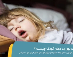 علت بوی بد دهان کودک