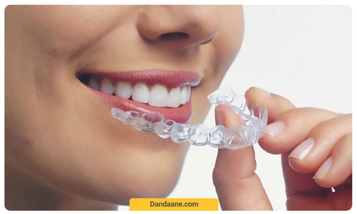 عکس خانمی که پلاک ارتودنسی خود را در آورده است