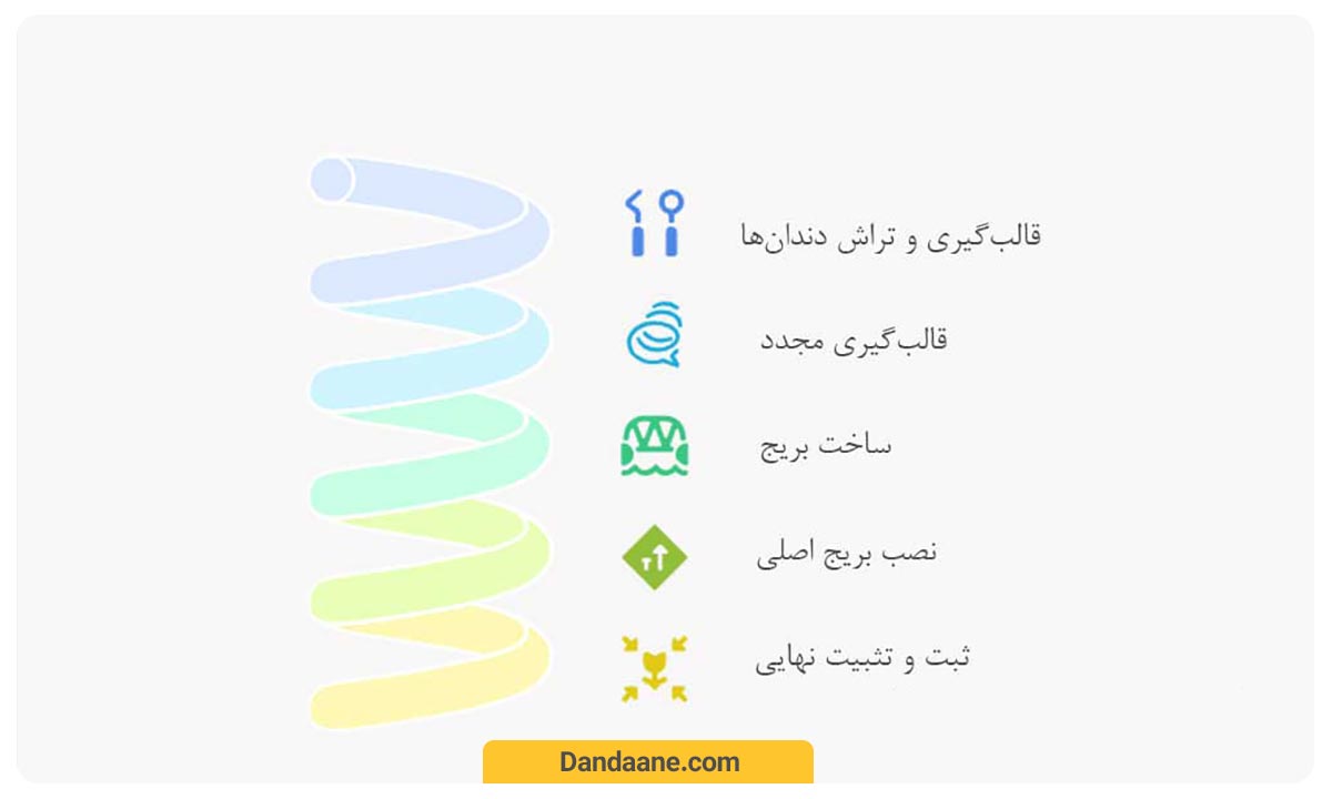 مراحل نصب بریج دندان