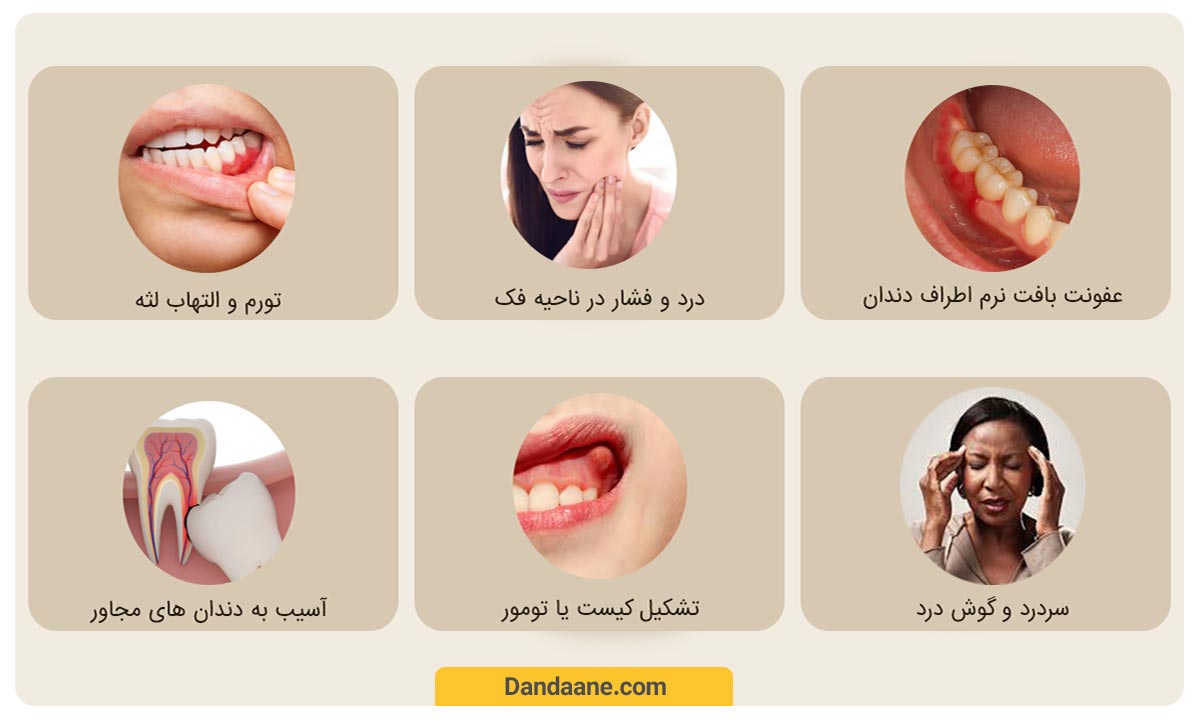 عوارض دندان عقل