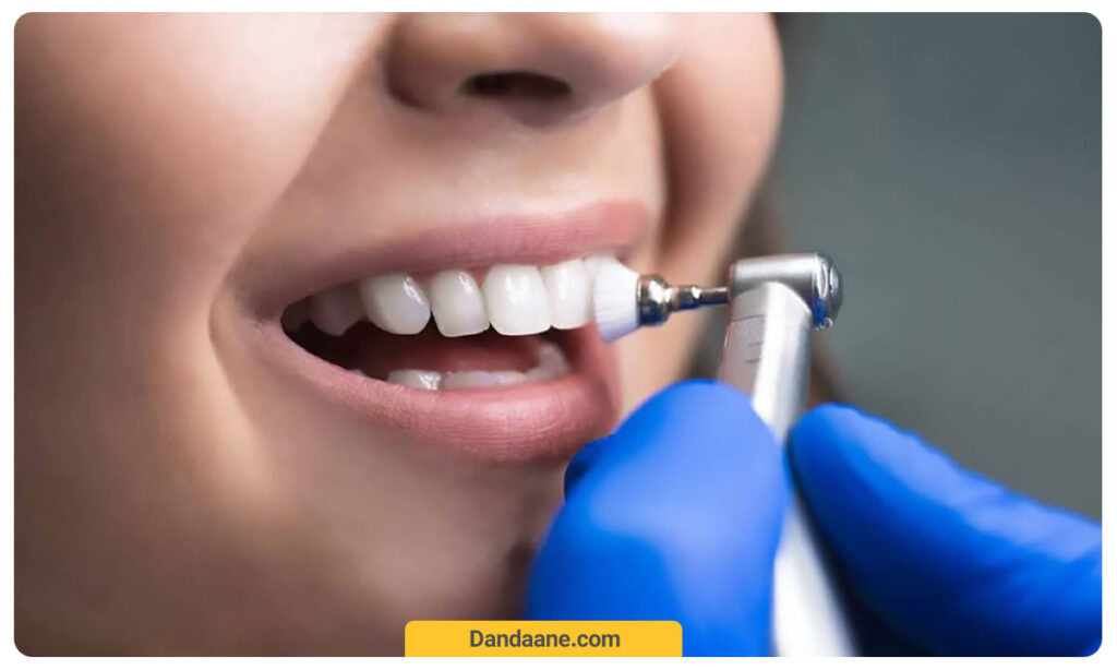 حساسیت دندان بعد از جرمگیری دندان