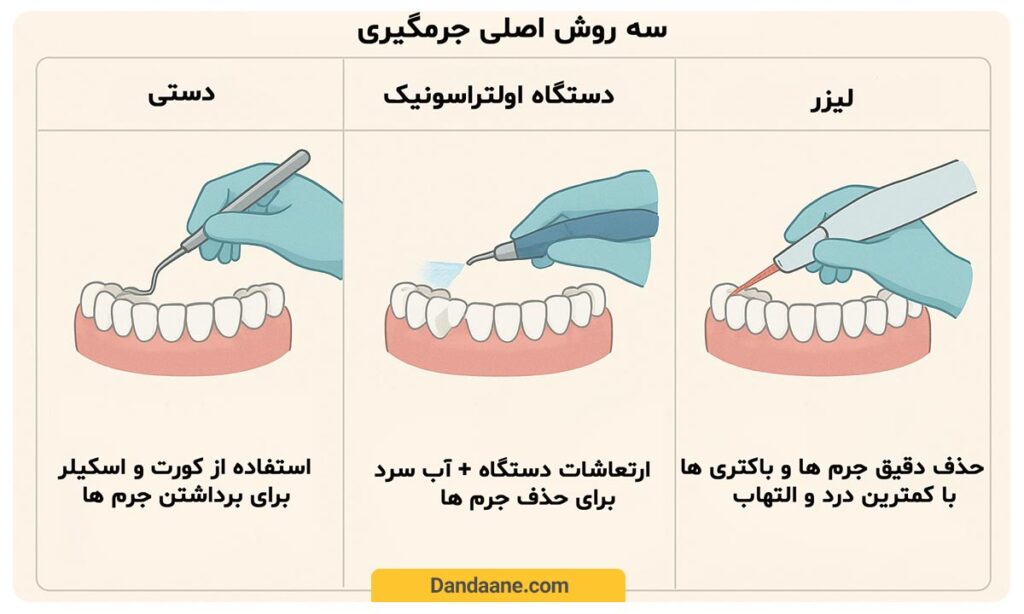 جرمگیری چگونه انجام می شود؟