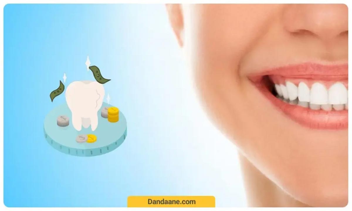 تصویر شماتیک از  کامپوزیت دندان 