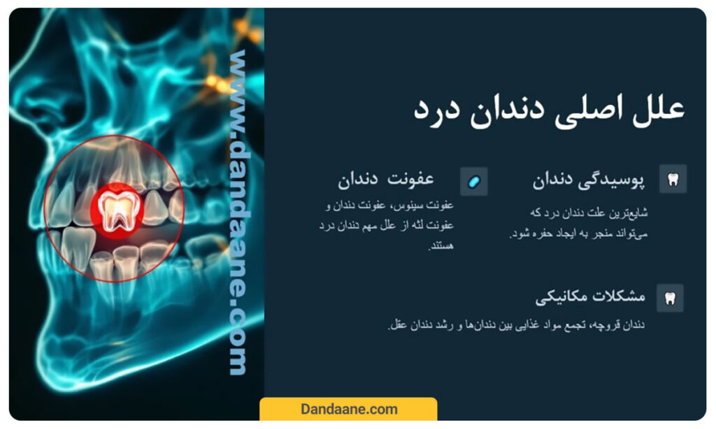 علت دندان درد