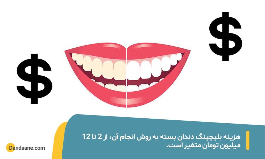 هزینه بلیچینگ دندان