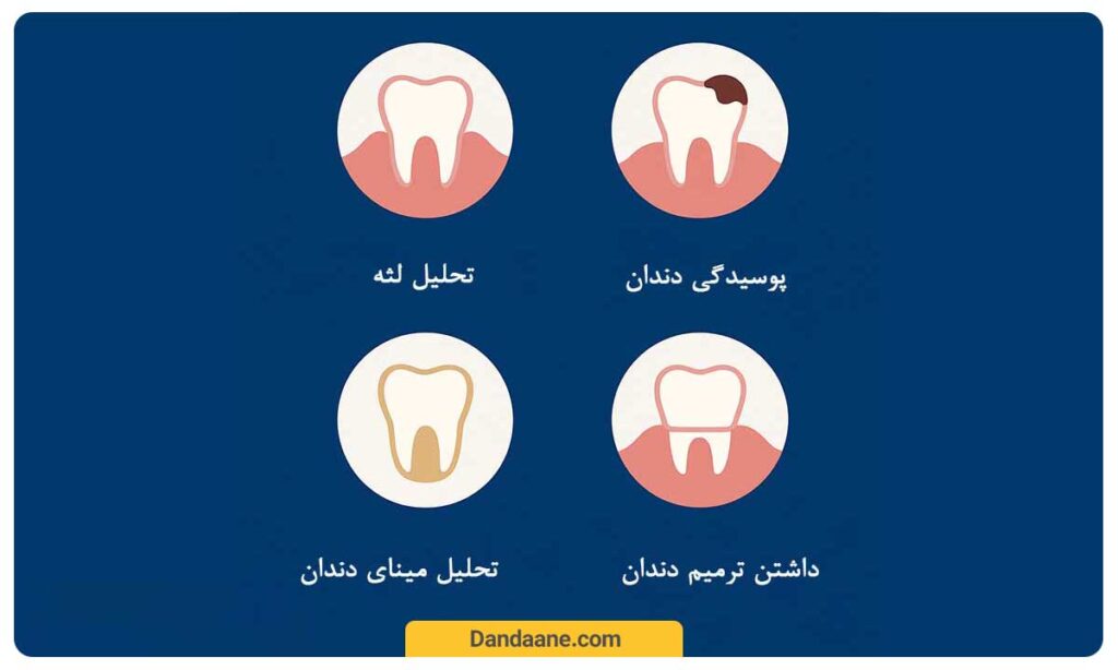 ممنوعیت بلیچینگ