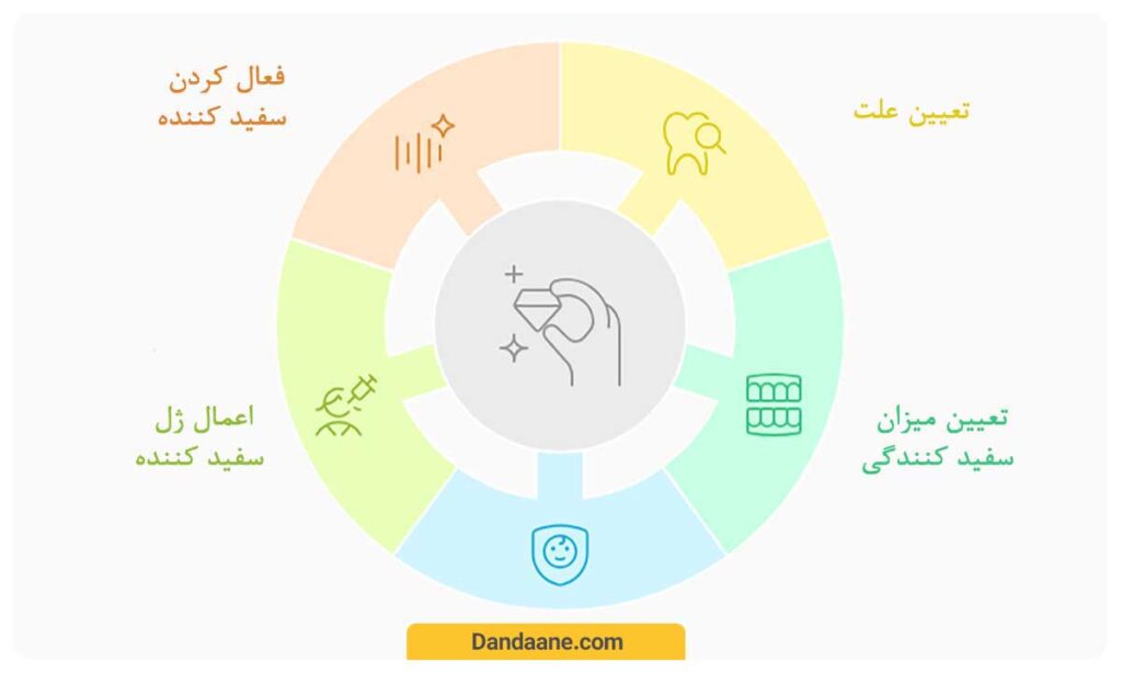 بلیچینگ در مطب 