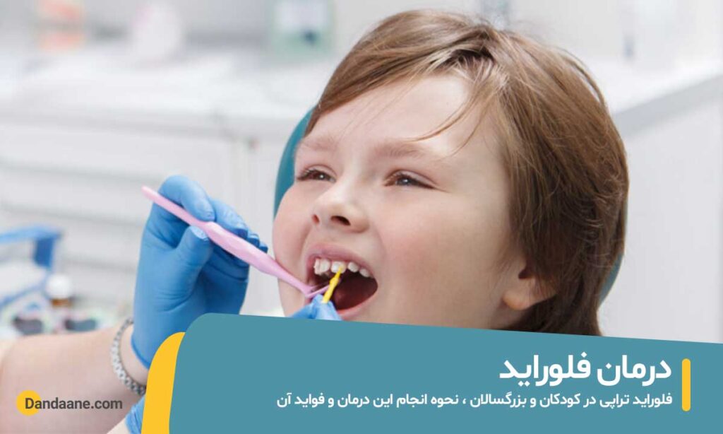 فلورایدتراپی